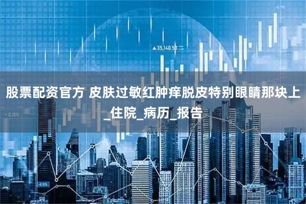 股票配资官方 皮肤过敏红肿痒脱皮特别眼睛那块上_住院_病历_报告